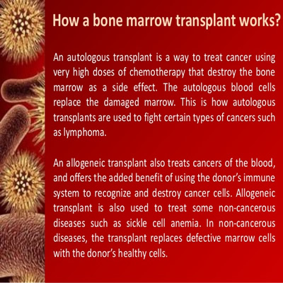 Hematologist (Bone Marrow Transplant)