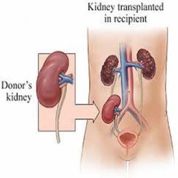 Kidney Transplant Unit