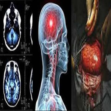 Neurology / Neurosurgery